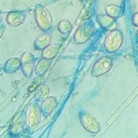 Managing tendon pain programme a series of short. Isolated strain of Phytophthora infestans visualised under ...
