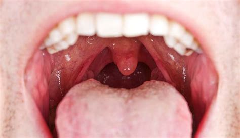 Mouth Anatomy Function And Care