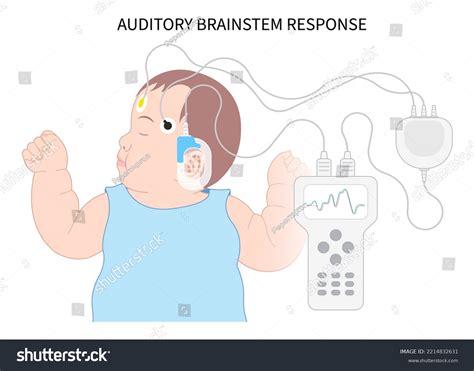 7 Auditory Brainstem Response Images Stock Photos And Vectors Shutterstock