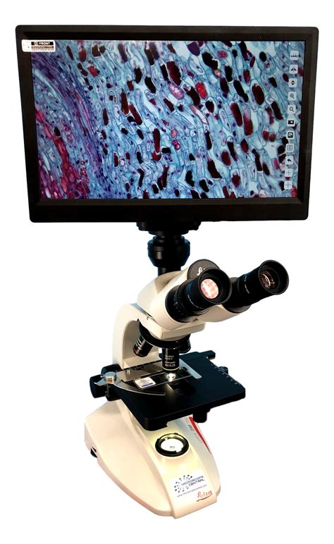 Leica Dm300 Hd Microscope With Screen High Definition Microscope