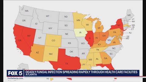 Deadly Fungal Infection Spreading Rapidly Across Us