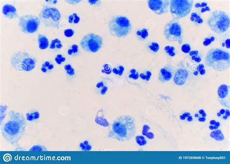 Blue White Blood Cell In Body Fluid Sample Stock Photo Image Of