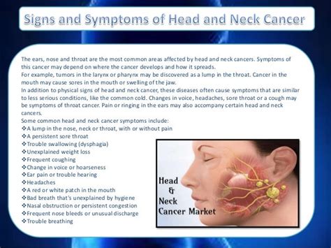 Signs And Symptoms Of Head And Neck Cancer