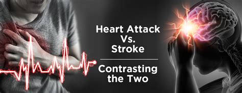 Heart Attack Vs Stroke Contrasting The Two Mmi