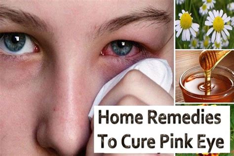 Fast And Easy Home Remedies To Cure Pink Eye And Itching Pink Eyes