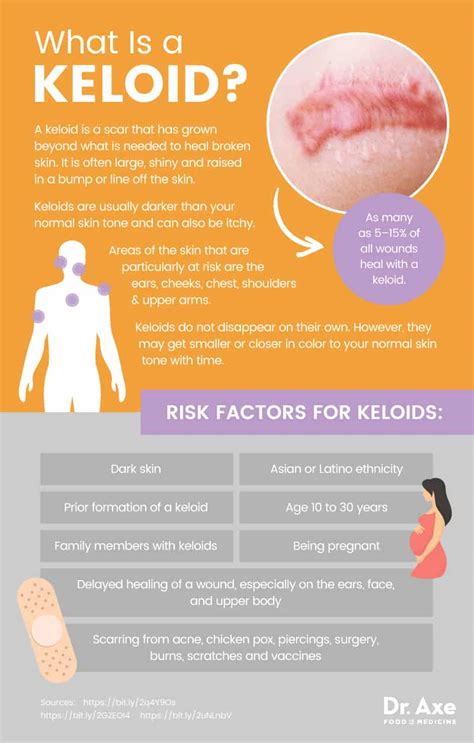 Keloid Causes Plus 5 Natural Tips To Help Treat Keloids Dr Axe