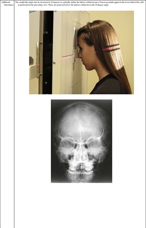 Radiographic Positioning Radiology Key