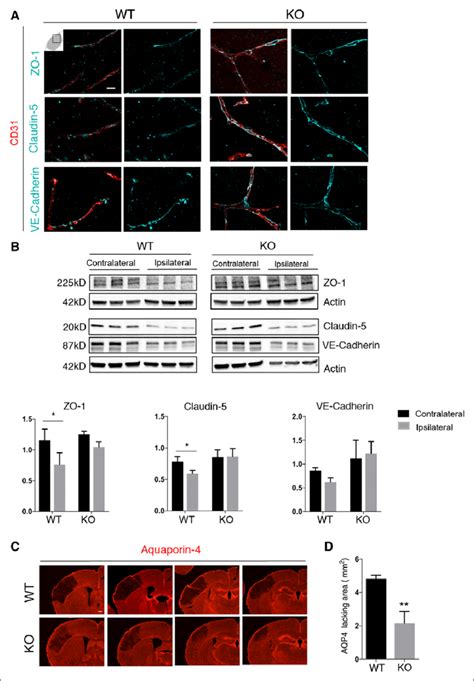 Loss Of Rgs Regulator Of G Protein Signaling In Pericytes