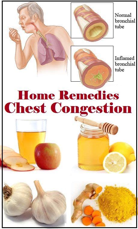 home remedies for chest congestion health remedies natural home remedies natural health remedies