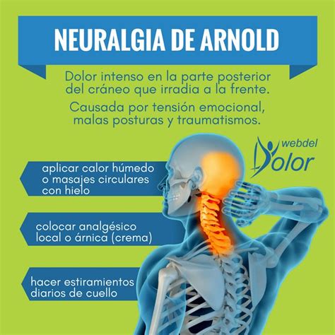 La Neuralgia De Arnold Produce Dolor En Parte Posterior De La Cabeza Te