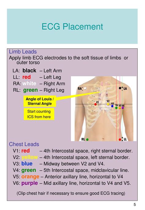 12 Lead Ecg Placement Test