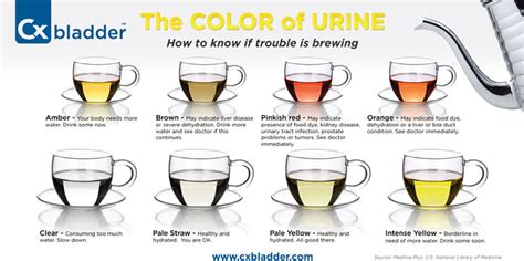 Non Invasive Urine Test For Bladder Cancer Cxbladder