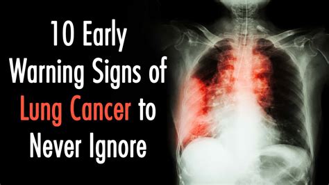 Early Warning Signs Of Lung Cancer To Never Ignore