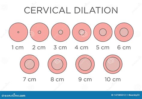 Cervial Dilation Medical Illustration Chart In Centimeters Stock