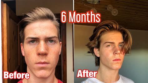 Mens Hair Growth Time Lapse 6 Months From Shaved Undercut Youtube