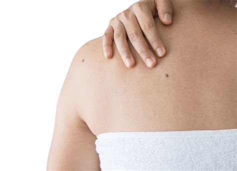 What Do Early Stages Of Skin Cancer Look Like Valley Dermatology