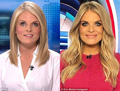 Erin Molan Opposes Nose Job Allegations After Plastic Surgeon Claims