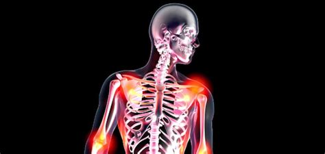 | meaning, pronunciation, translations and examples. Épinglé sur fibromyalgie