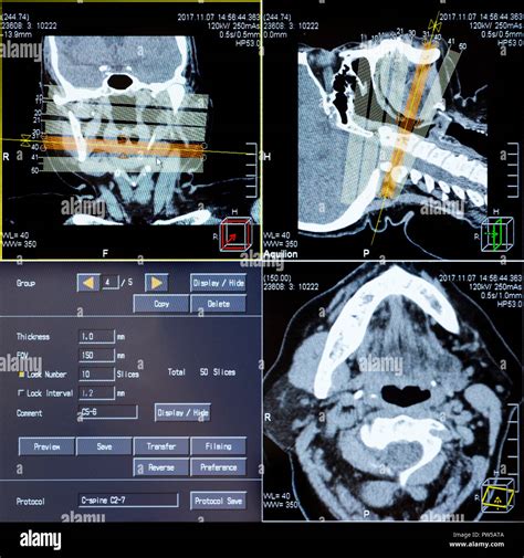 Magnetic Resonance Imaging Mri Scan Ct Scans Of Human Head On A