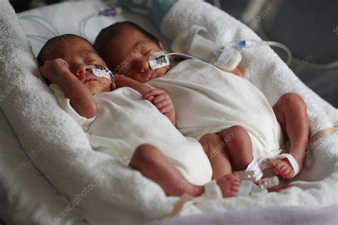 Premature Identical Twins Stock Image C0524723 Science Photo Library