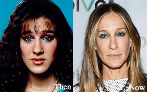 Sarah Jessica Parker Plastic Surgery Before And After Photos
