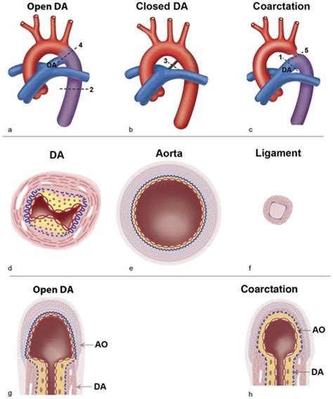 Fileaortic Arch And Ductus Arteriosus Embryology