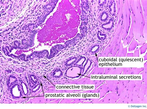 Normal Prostate Histology Анатомия
