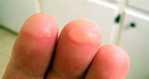Ultimate Guide To Guitar Finger Pain Stop Sore Fingers Guitar Gear