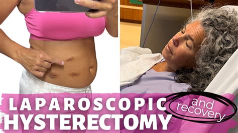 My Laparoscopic Hysterectomy Story Recovery Surgical Menopause What