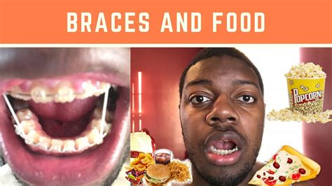 Braces And Food Youtube