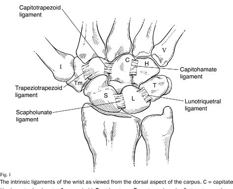 Ulnar Sided Wrist Pain Diagnosis And Treatment Semantic Scholar