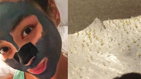 How To Get Rid Of Blackheads The Right Way Glamour