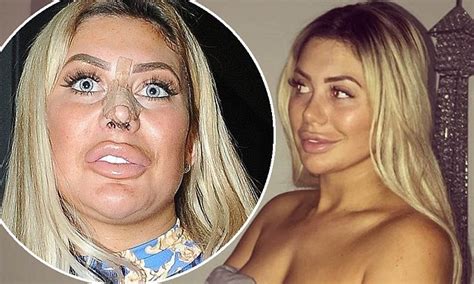 Chloe Ferry Nose Job Geordie Shore Star Shows Off New Look Daily