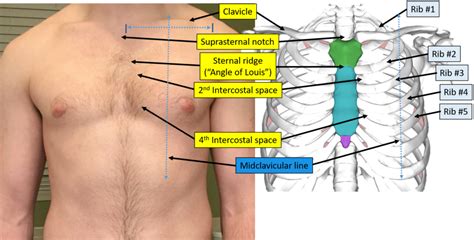 The rib cage is an origin and insertion area for many muscles. Proper Electrocardiogram (ECG/EKG) Lead Placement