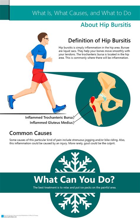 The Symptoms Causes Risk Factors And Treatment Of Hip Bursitis Page