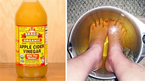 Put Your Feet In Apple Cider Vinegar For 30 Minutes Every Day For A