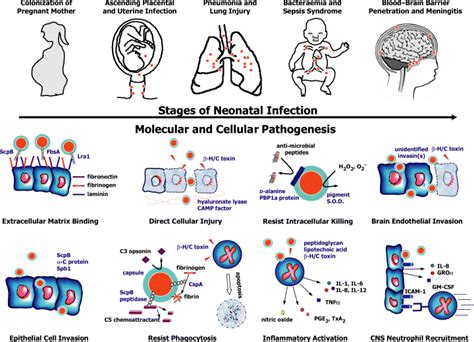 Molecular Pathogenesis Of Neonatal Group B Streptococcal Infection No Longer In Its Infancy