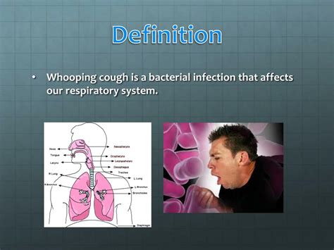 whooping cough powerpoint    id