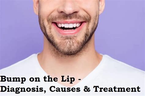 What Is A Bump On The Lip Diagnosis Causes And Treatment Magnificent Post