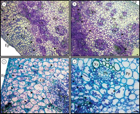 Mar 09, 2021 · first, xylem is a complex tissue and includes living cells. Microscope Xylem Cell - Micropedia