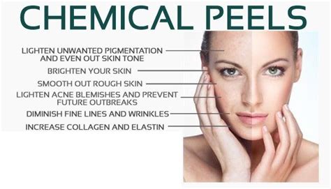 Chemical Peel Mercerville Skins Texture Treatment Monroe Twp Mercer