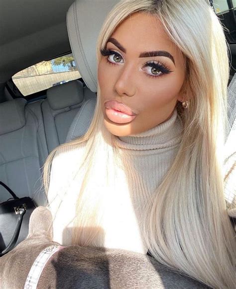 Chloe Ferrys Lips Spark Concern For Star Among Fans As They Say Her