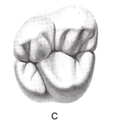 Maxillary Second Molar Diagram Quizlet