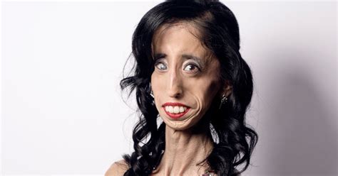 How Being Called The Worlds Ugliest Woman Transformed Her Life Huffpost