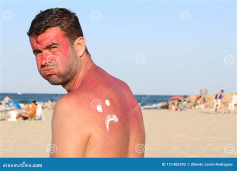 Man Getting Sunburned At The Beach Stock Photo Image Of Summer Male