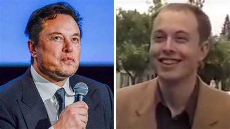 Elon Musk Likely ‘spent 172k On Secret Surgery Hair Transplants Surgeon Trendradars