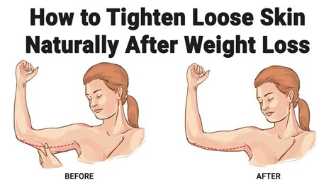 8 natural ways to tighten sagging skin after weight loss