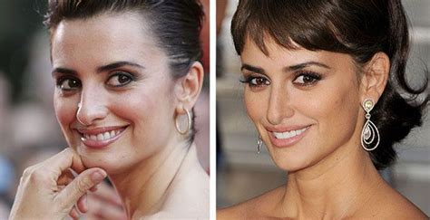 Celebrity Penelope Cruz Before And After Plastic Surgery Nose Job