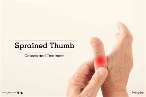 Sprained Thumb Causes And Treatment By Dr Kapilchand Narra Lybrate