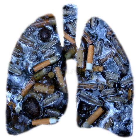 Smokers Lungs Stock Photo Image Of Effects Stop Anatomy 945380